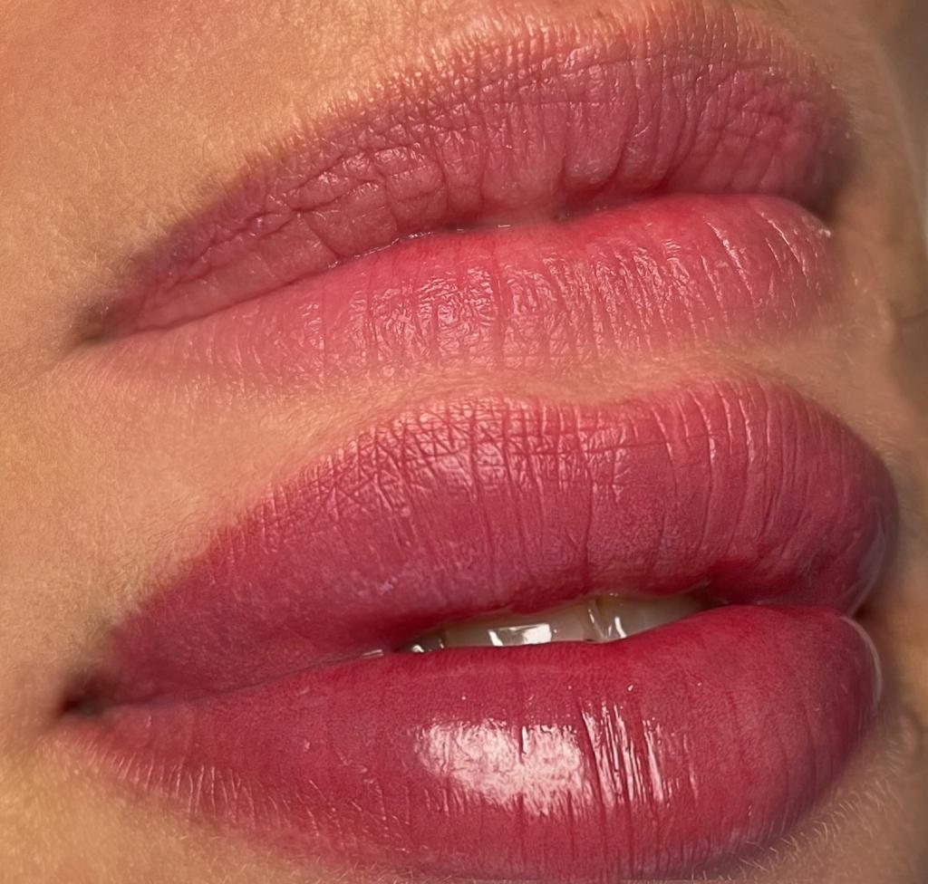 Lippen nach der Behandlung — modellierte Kontur