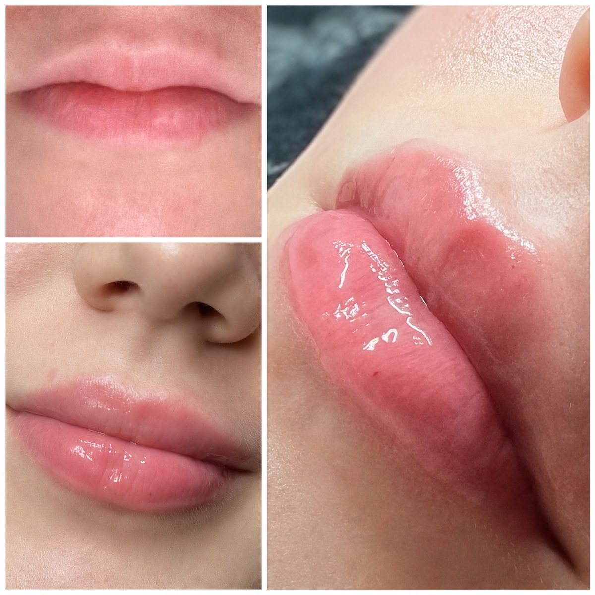 Lippen vor und nach der Behandlung — Form und Glanz